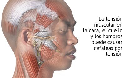 ¿Qué es la cefalea tensional? Tu Fisioterapeuta a domicilio en Alicante para el dolor de cabeza.